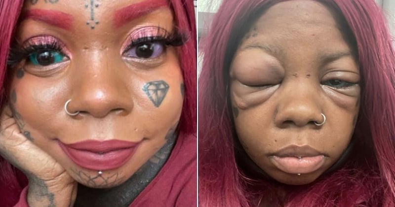 Cette maman va devenir aveugle parce qu'elle s'est fait tatouer les yeux malgré les avertissements de ses enfants