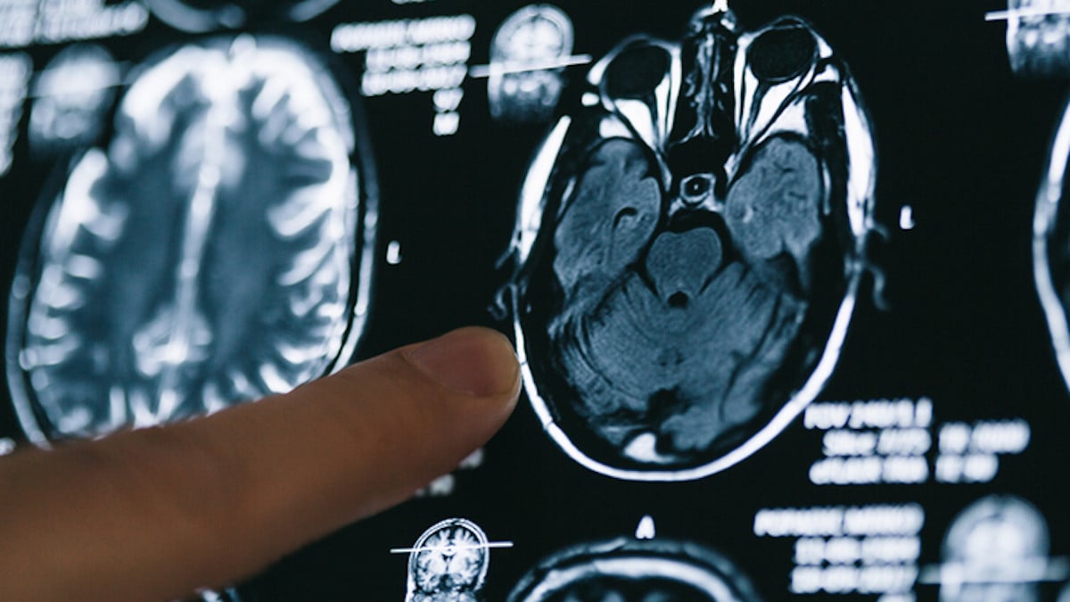 Une radiologie du cerveau