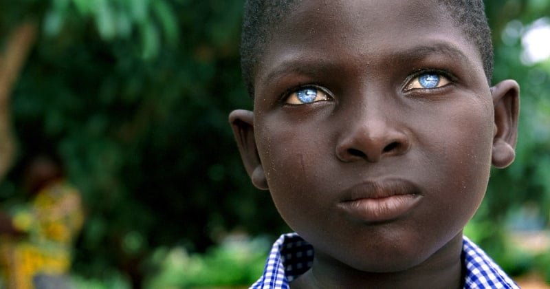 Une étude scientifique affirme que les ancêtres des Irlandais étaient noirs avec des yeux bleus