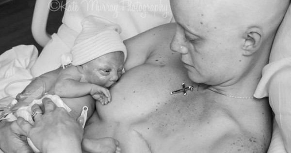Survivante du cancer, une maman allaite son fils pour la toute première fois après sa mastectomie. La beauté à l'état pure...