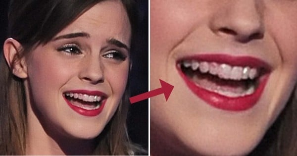 18 problèmes quotidiens que seules les filles qui adorent porter du rouge à lèvres connaissent
