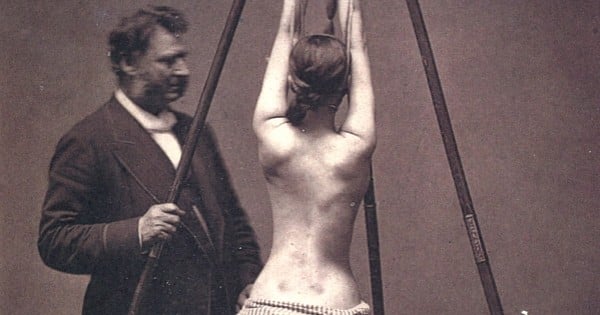 24 photos flippantes de la médecine du passé qui vont vous donner des cauchemars