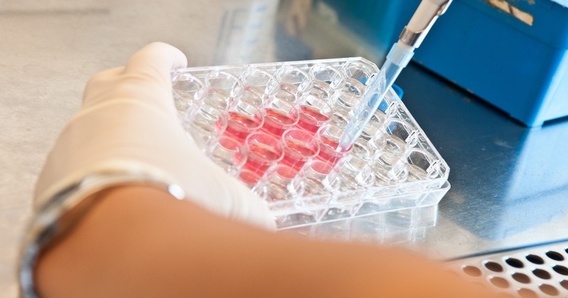 Nouvel espoir dans la recherche pour la cancer : Un test sanguin pour détecter un possible risque de tumeur