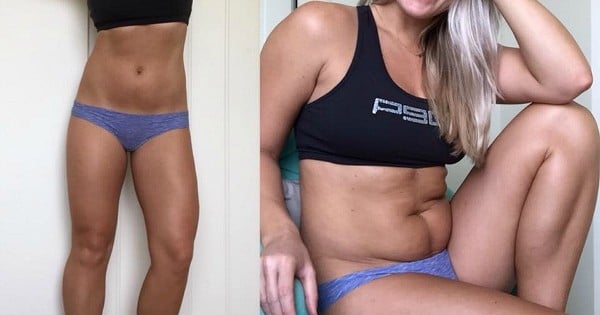 En seulement deux photos, cette prof de fitness a prouvé au monde entier que le corps parfait n'existait pas et qu'il fallait arrêter de baver sur les gens parfaits de Instagram