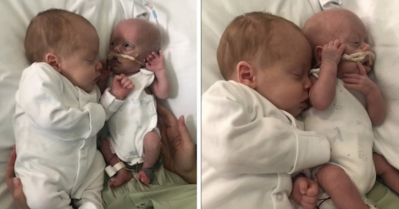 Ce bébé prématuré ne pesant que 485 grammes a continué à se battre grâce aux câlins de son frère jumeau