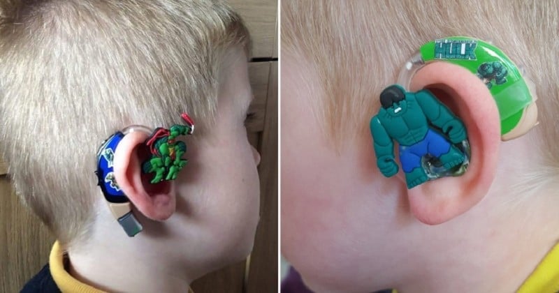 Cette maman décore les appareils auditifs des enfants afin de les rendre fiers de les porter ! 