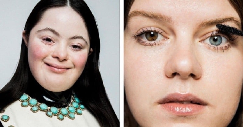 Atteinte de trisomie 21, la mannequin Ellie Goldstein a posé pour Gucci et va apparaître dans Vogue