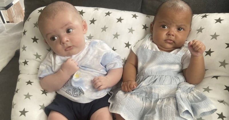 Angleterre : elle accouche de jumeaux à la couleur de peau différente 