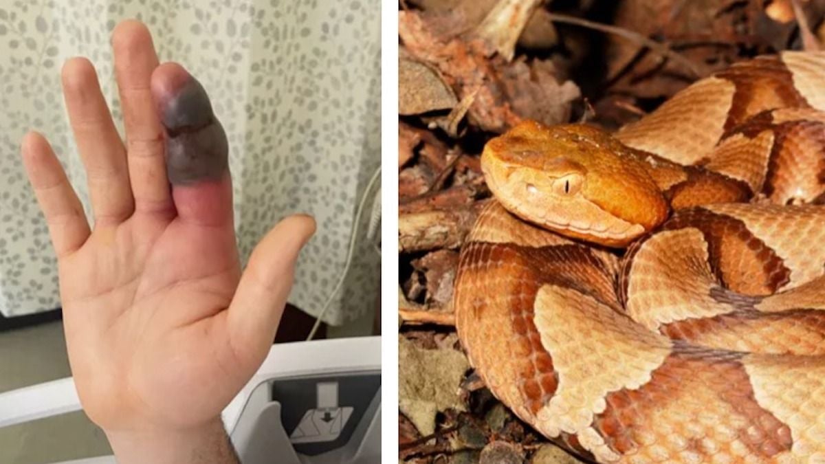 Il sauve un serpent sans savoir qu'il est venimeux et termine à l'hôpital 