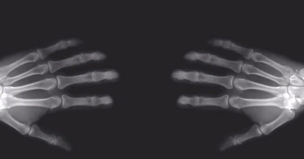 Un homme a craqué ses doigts sur une main et pas l'autre pendant 60 ans... Regardez ce qu'il a découvert !