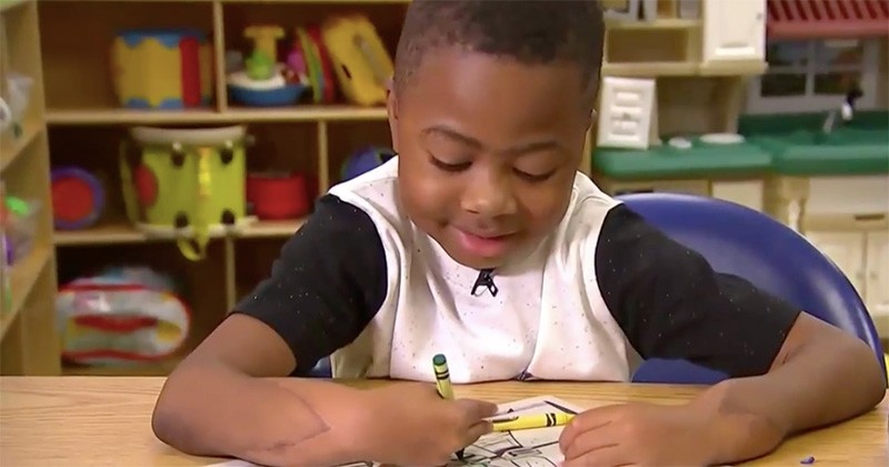 Après avoir été greffé des deux mains en 2015, cet enfant peut désormais écrire et manger tout seul