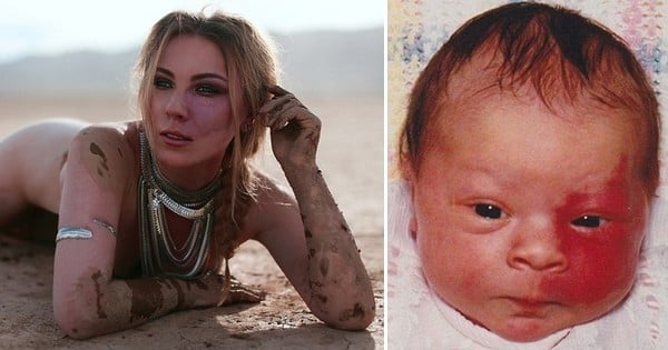 Cette actrice de 23 ans fait évoluer les codes de la beauté et fait de sa tache de naissance sur le visage un « défaut » formidable