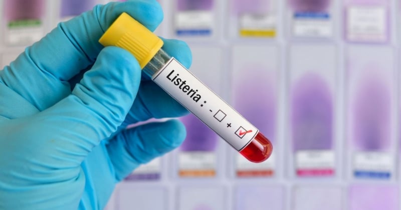 Listériose : les symptômes en cas d'infection à la listéria