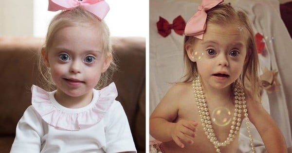 Cette petite fille trisomique, d'à peine 2 ans, est devenue mannequin grâce à ses grands yeux bleus... Elle est magnifique !