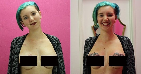 A 23 ans, elle décide de prendre le dessus sur la maladie après avoir subi une double mastectomie ! Son histoire est vraiment touchante…