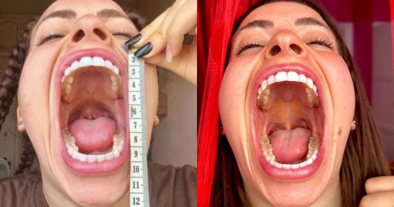 Cette femme de 22 ans aurait « la plus grande bouche du monde » et le prouve avec des photos impressionnantes