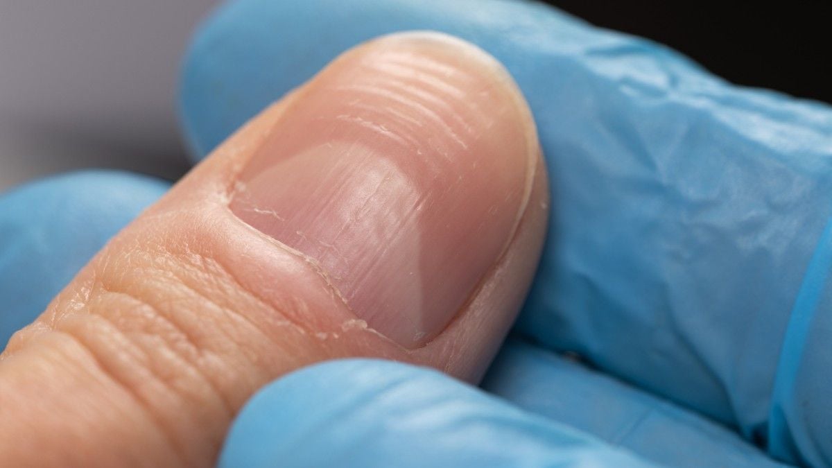 Vous avez les ongles striés ? Vous devriez faire attention