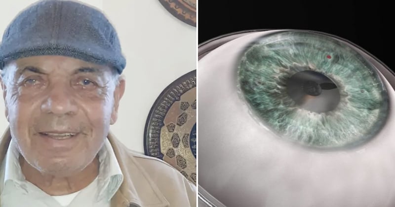 Une greffe de cornée artificielle permet à un homme aveugle de recouvrer la vue, une première mondiale