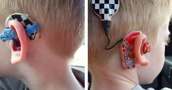 Une maman a trouvé le moyen d'aider les enfants qui ont des prothèses auditives à mieux accepter cet handicap ! Découvrez le concept génial qu'elle a inventé !