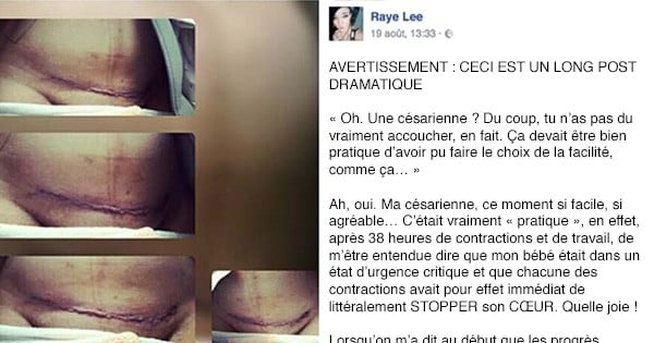 Marre qu'on lui dise « qu'accoucher par césarienne » a dû être « plus facile pour elle », cette maman a décidé de remettre les pendules à l'heure dans un post devenu viral sur Facebook