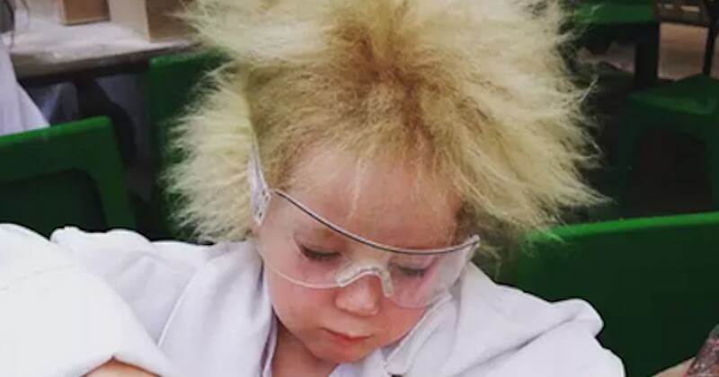Cette petite fille, atteinte du syndrome des cheveux incoiffables, ressemble à Albert Einstein