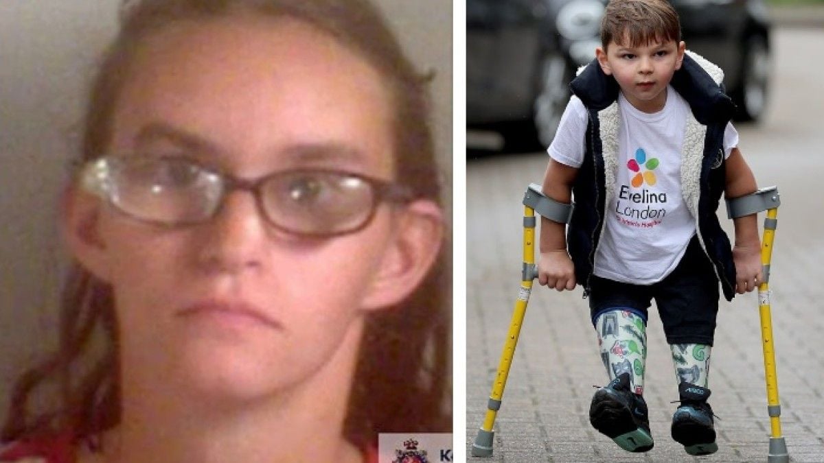 Elle a torturé son fils au point de lui faire perdre ses deux jambes... et va être libérée de prison après seulement 7 ans