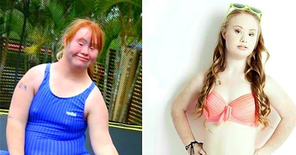 Cette fille de 18 ans est atteinte de trisomie 21 et veut devenir... mannequin ! Elle a vraiment tout pour plaire...