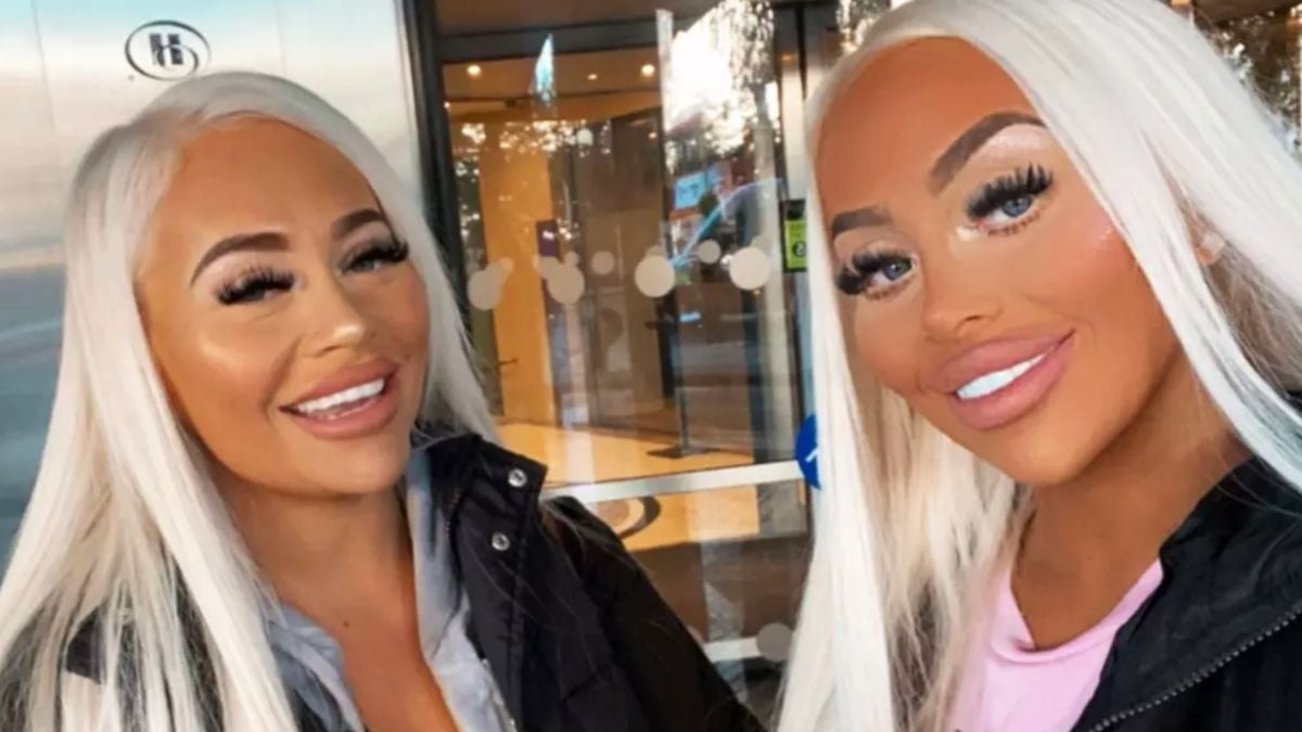 Ces jumelles fan de Barbie dépensent 100 000€ en chirurgie esthétique pour ressembler à leur idole !