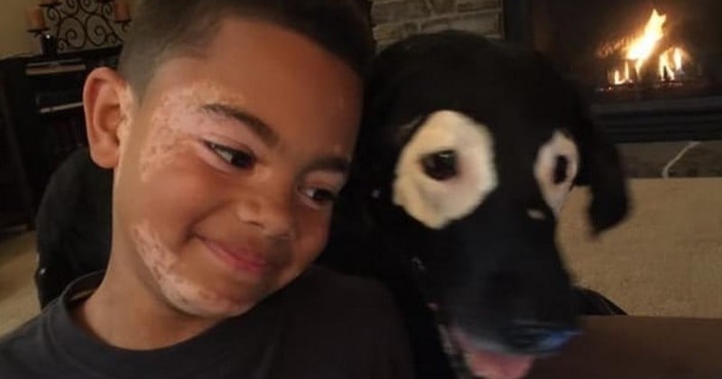 Grâce à ce chien, ce petit garçon, lui aussi atteint de leucodermie (vitiligo), a pu s'accepter avec ses taches et gagner en confiance en soi !