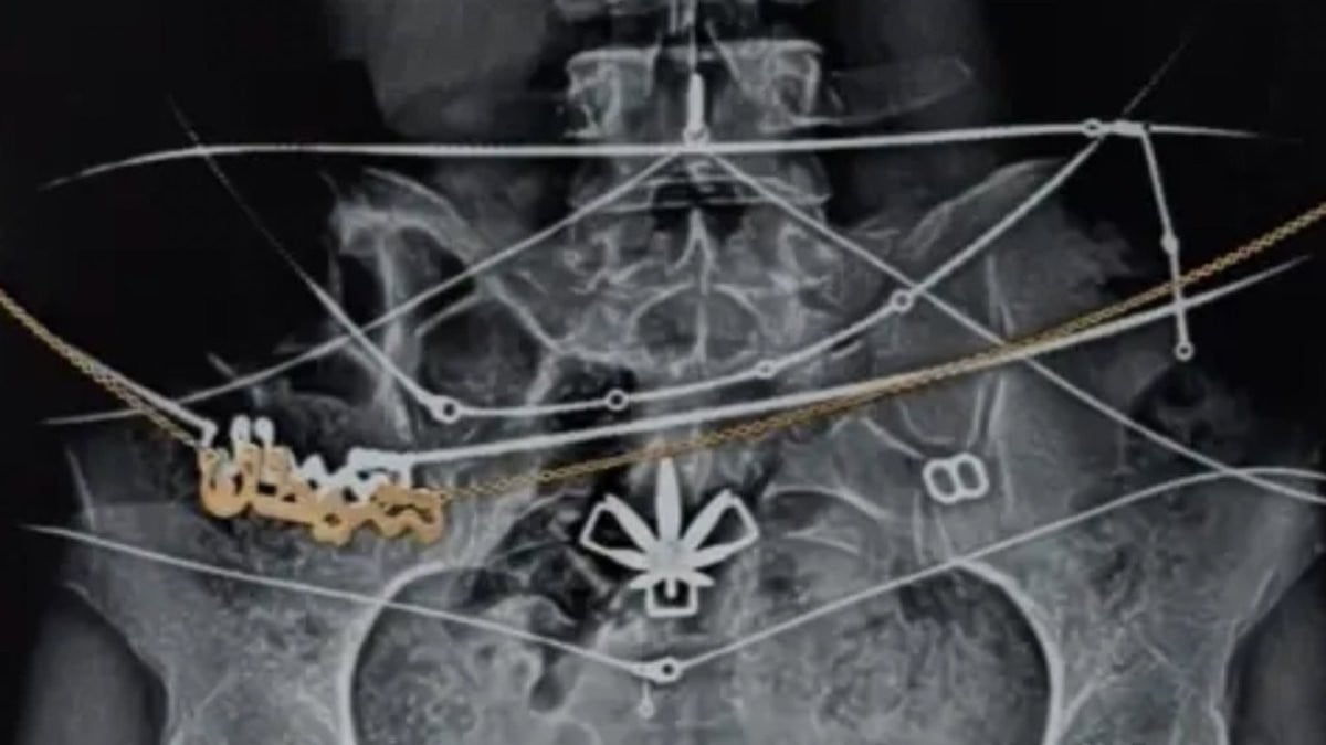 Mia Khalifa publie une radiographie de son corps pour se réapproprier son image après avoir quitté le porno