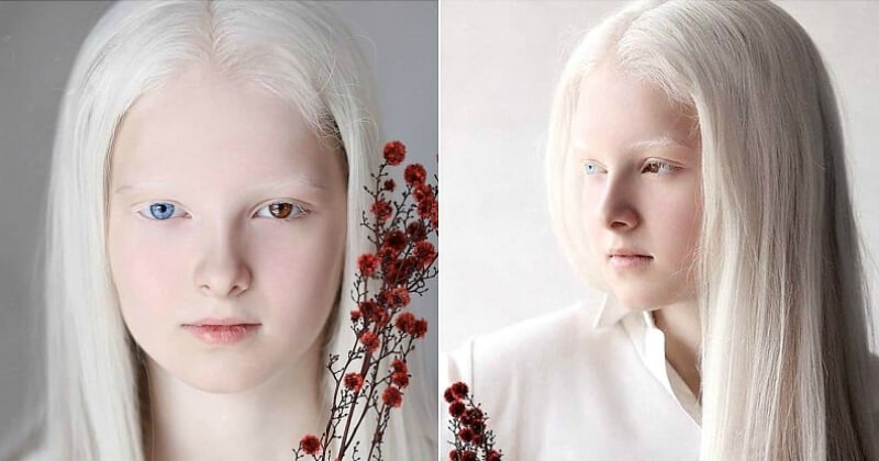 Avec ses cheveux blancs et ses yeux de couleurs différentes, cette jeune fille émerveille le monde