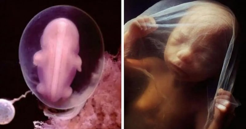 Ces 23 photos de la croissance d'un bébé dans le ventre de sa maman sont une merveilleuse ode à la vie 