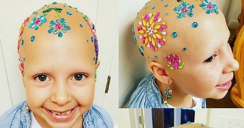 Cette petite fille souffrant d'une alopécie a participé à sa manière au concours de la coiffure la plus folle de son école... Et elle a tout déchiré !