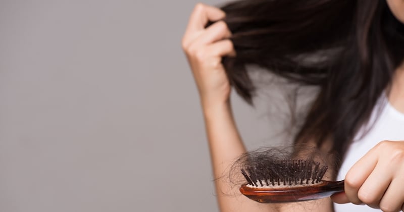 Perdre ses cheveux n'est pas une fatalité, on te donne des conseils pour y remédier