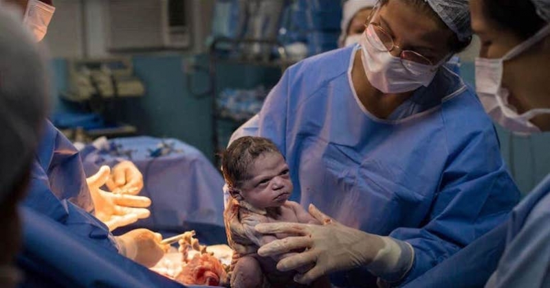 Après sa naissance, cette petite fille dévisage les médecins qui l'ont mise au monde 
