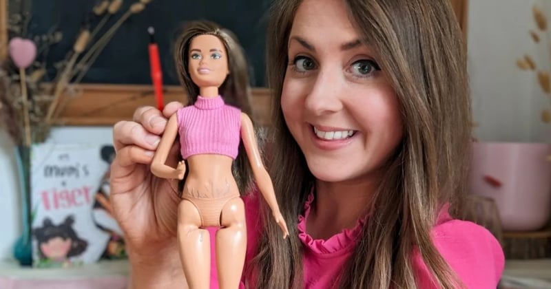 Cette maman peint des vergetures sur une Barbie pour sensibiliser sa fille