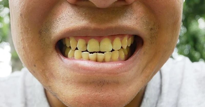 5 boissons qu'il faut absolument réduire pour éviter d'avoir les dents jaunes