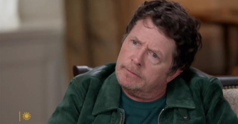 Atteint de la maladie de Parkinson, Michael J. Fox ne se voit pas vivre encore longtemps