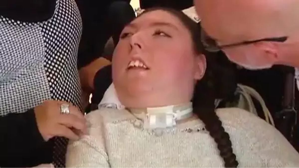 Cette jeune fille née sans cerveau fête ses 20 ans, « un miracle » pour sa famille 