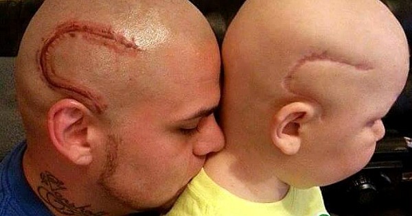 Il se fait tatouer la même cicatrice que son fils atteint d'un cancer pour le soutenir dans cette épreuve... Magnifique ! 