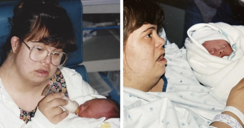 Atteinte de trisomie 21, elle donne naissance à un bébé souffrant de la même maladie et l'élève en tant que mère célibataire 
