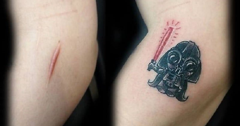 Des tatoueurs transforment les cicatrices et les taches de naissance afin de les rendre plus jolies