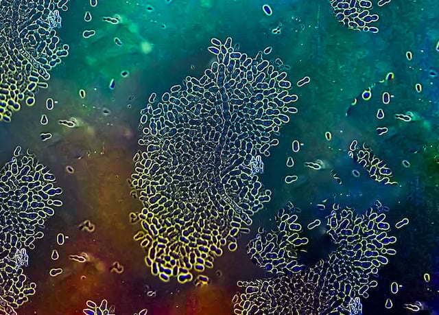 Champignon Malassezia au microscope 