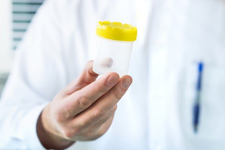Un médecin donne un flacon à un donneur de sperme