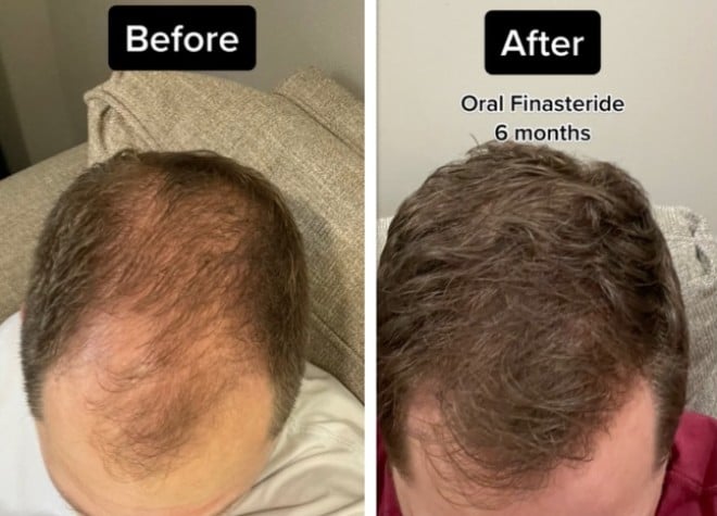 Les cheveux avant/après le produit