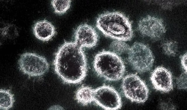 Une image au microscope de cellules 