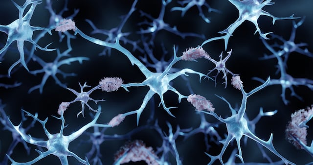 Maladie d'Alzheimer 