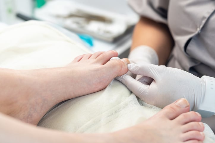 Un médecin examine des ongles de pied