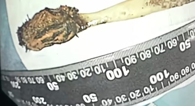 La brosse à dents retrouvée