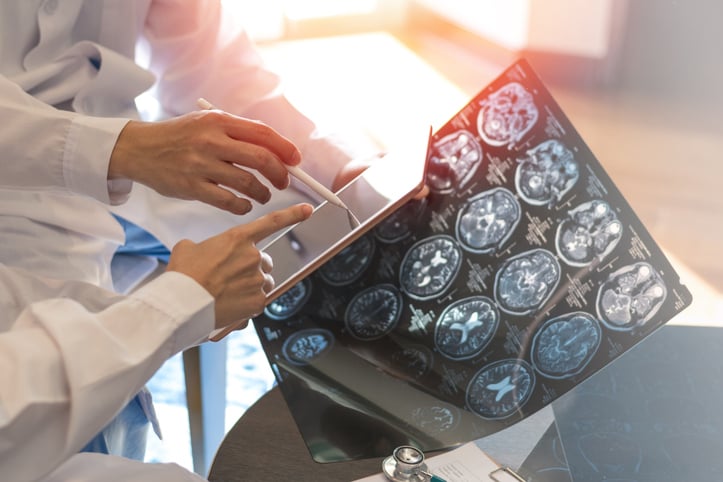 Des scans d'un cerveau